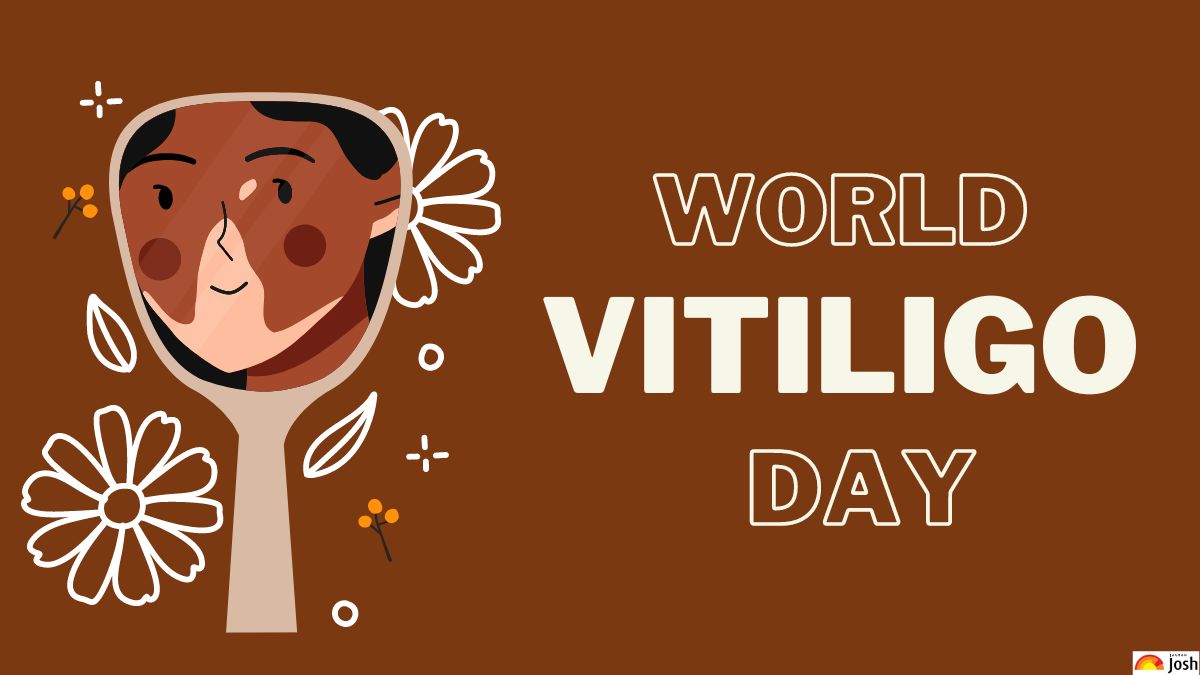 All you need to know about Vitiligo.